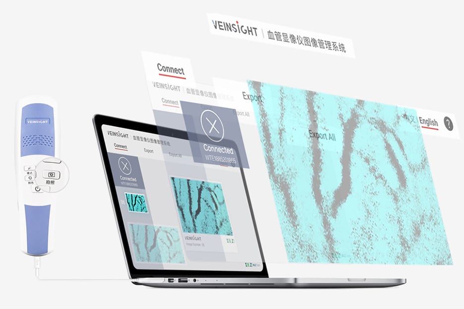 VeinSight静脉显像仪/静脉显示仪/血管显像仪/VS500/功能展示